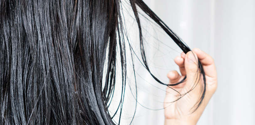 Todo lo que necesitas saber acerca del cabello graso